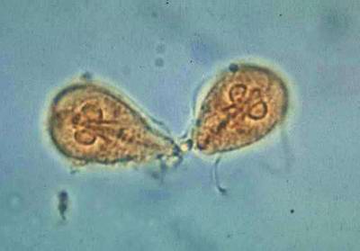 Parasitology Flashcards Memorang