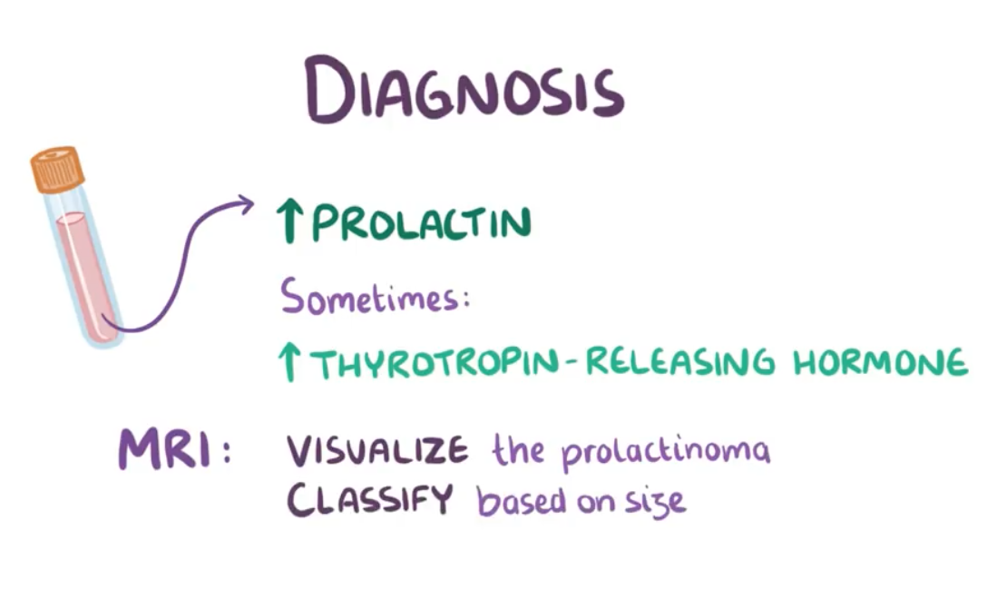 Prolactinoma Flashcards | Memorang