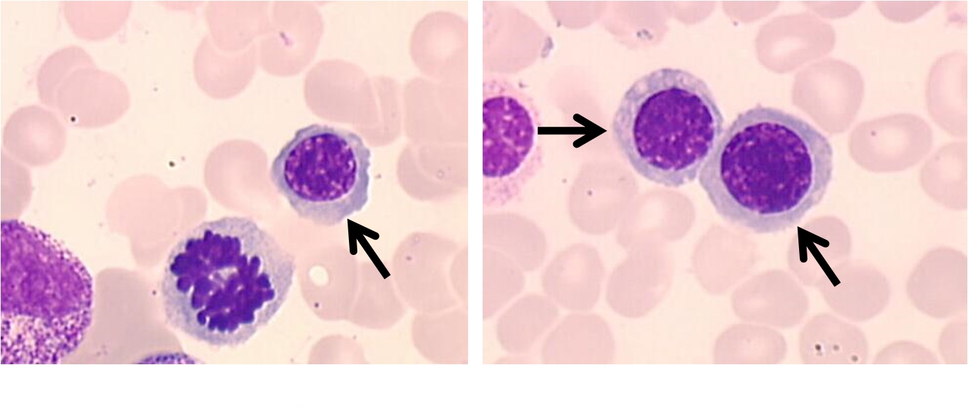 Hematology Flashcards Memorang