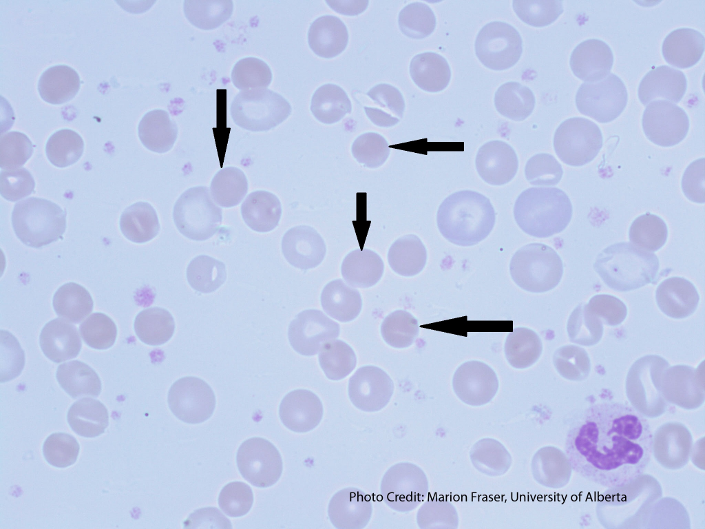 Hematology/Oncology Images Flashcards | Memorang