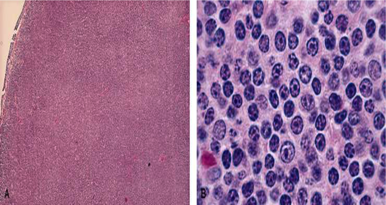 Hematology Flashcards Memorang