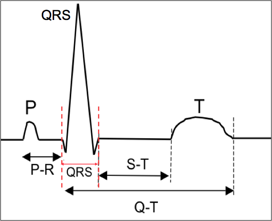 ECG Flashcards | Memorang