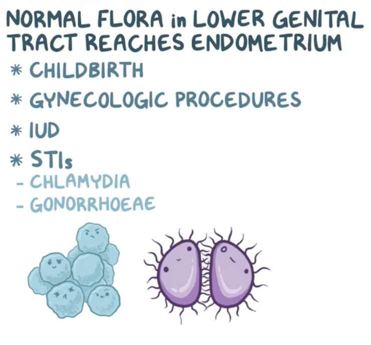 endometritis icd 10