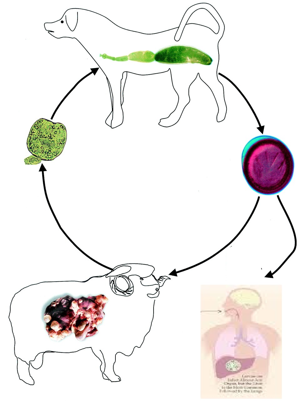 Pulmonary Echinococcosis or Lung Hydatidosis: A Narrative Review | Surgical  Infections, image size:959x1280