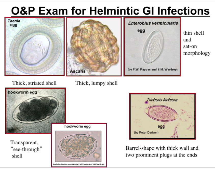 parasitic helminths exam