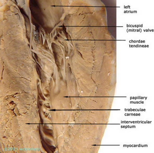 trabeculae carneae vs papillary muscle