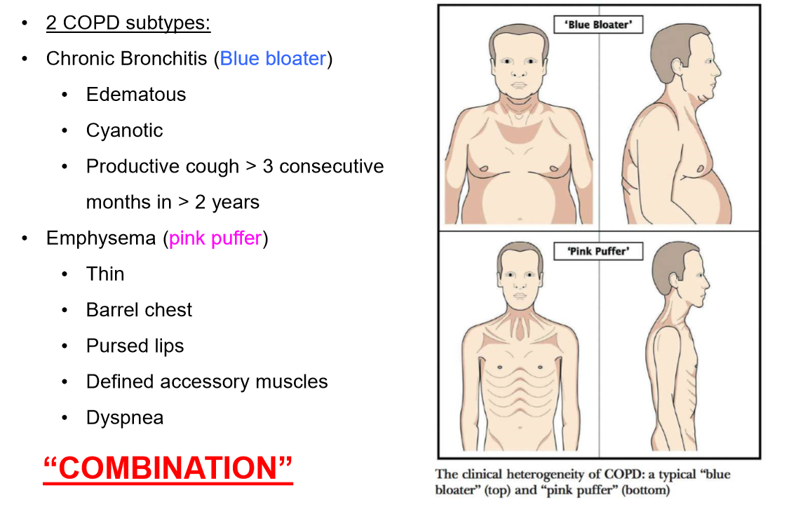 Barrel Chest Copd Emphysema