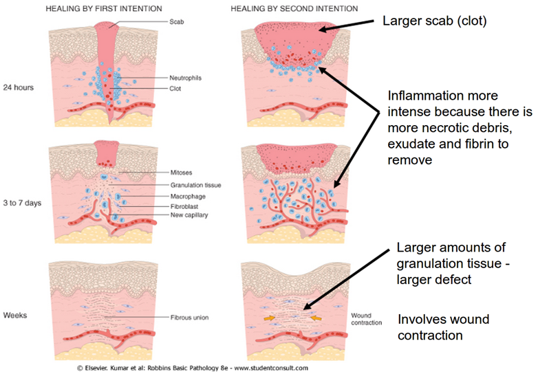 Derm/Rheum Flashcards | Memorang