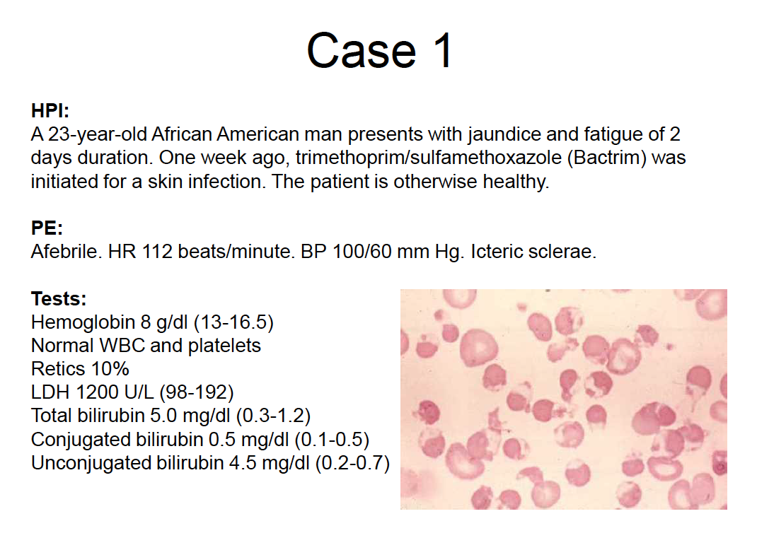 Hemolytic Anemia 1/13 Flashcards