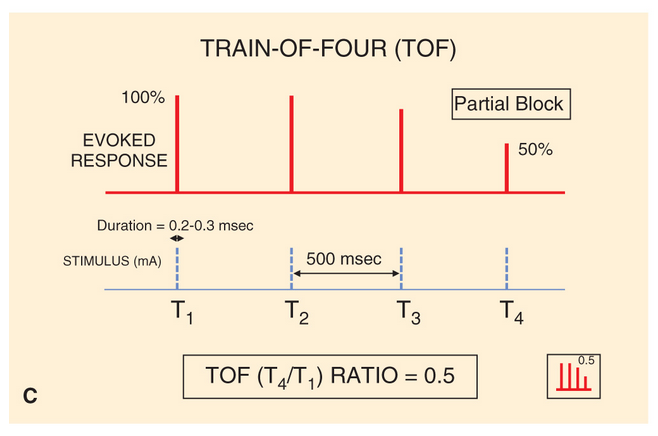 Neuromuscular Monitoring Flashcards Memorang