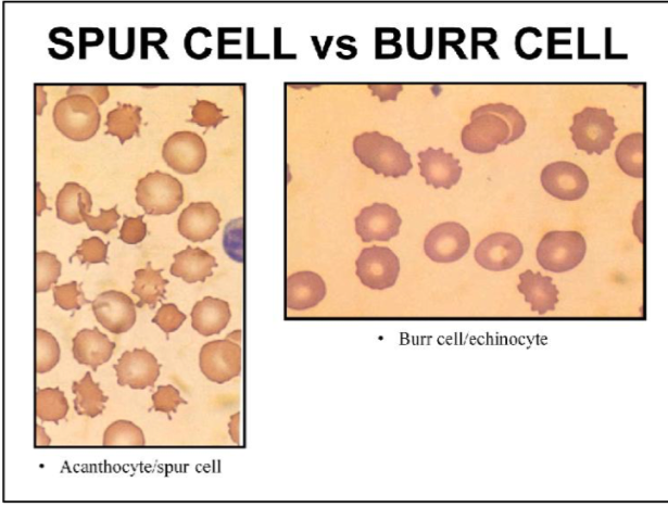 spur cells