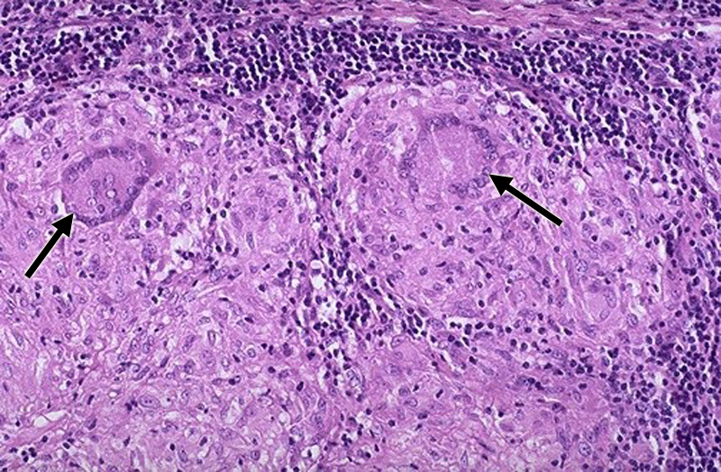 Mycobacterium Flashcards | Memorang