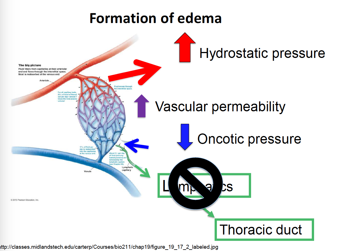 Edema Definition, Pathophysiology, Causes, Clinical, 59% OFF