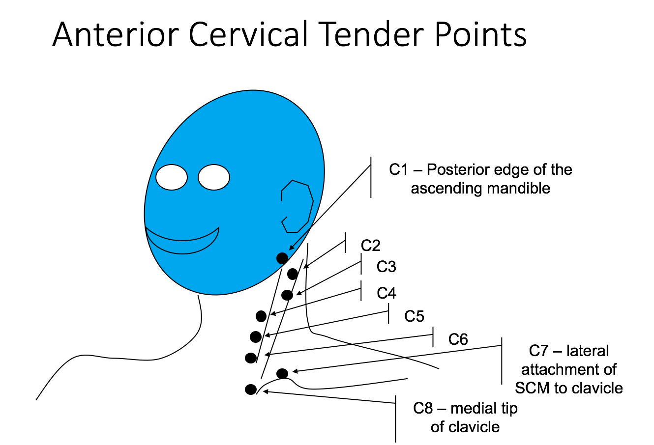 Tender Points Flashcards | Memorang