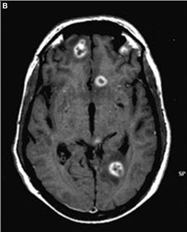 Brain Flashcards Memorang