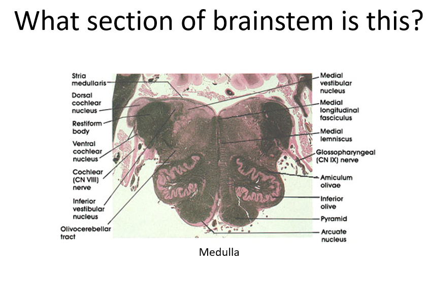 Stria Medullaris Brainstem