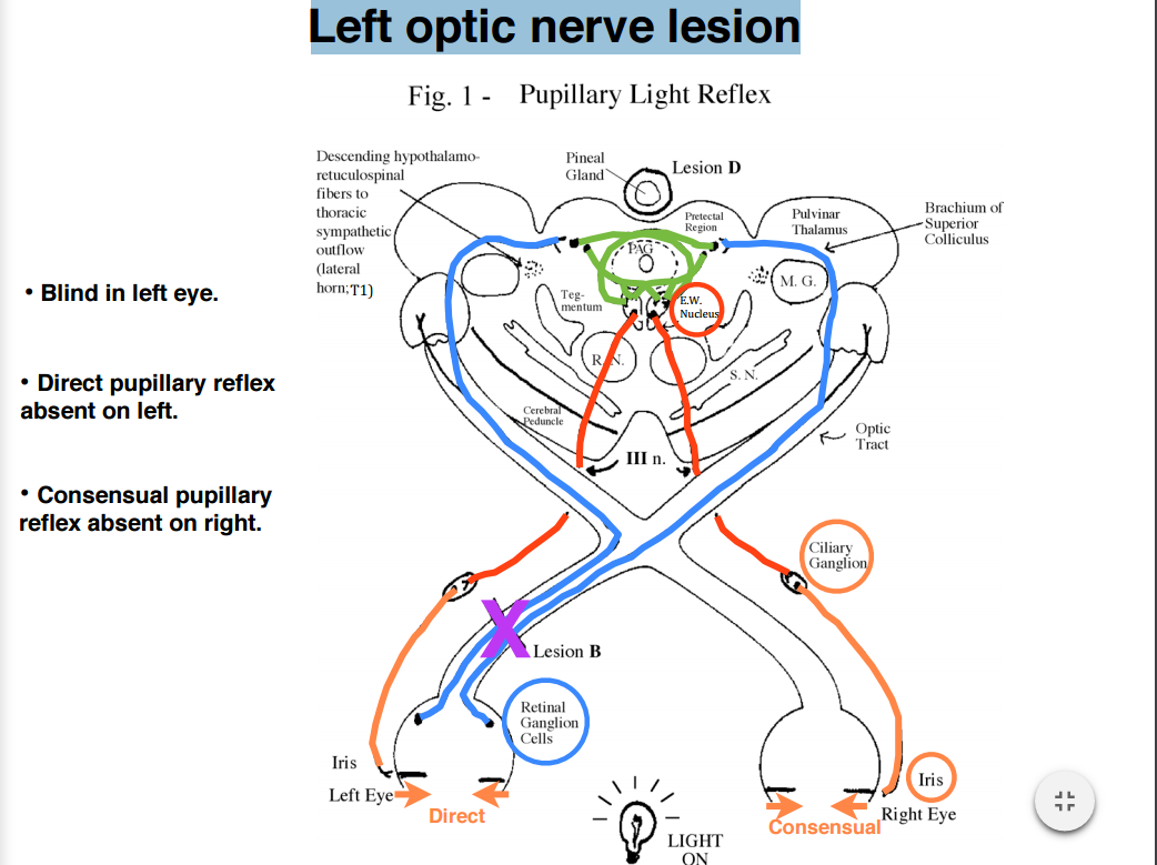 Mice Lacking Melanopsin Exhibit An Incomplete Pupillary Light Reflex At Download Scientific Diagram