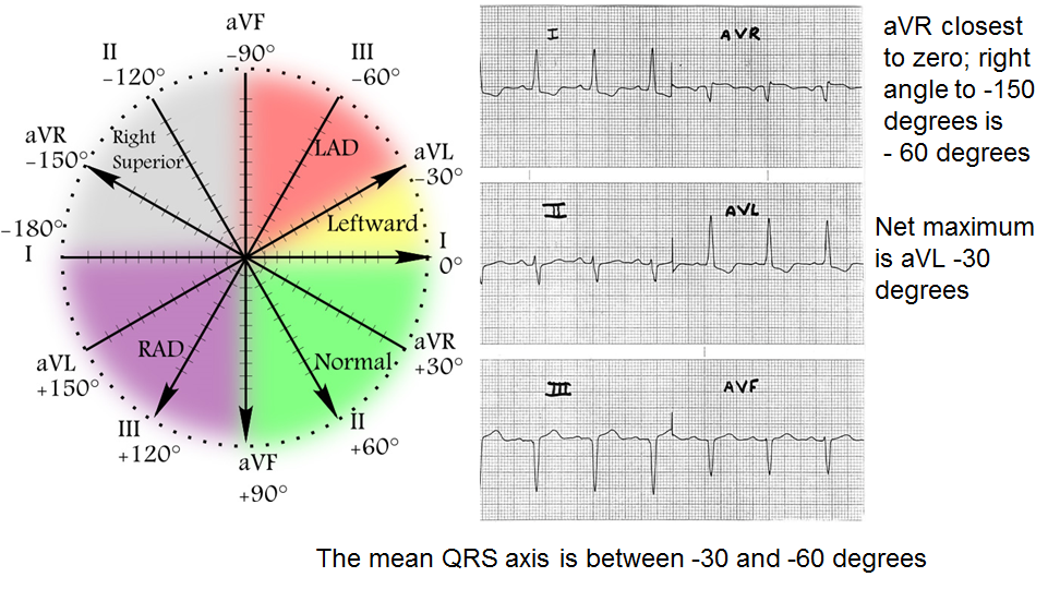 Basic Electrocardiogram (ECG) Flashcards Memorang, 44% OFF