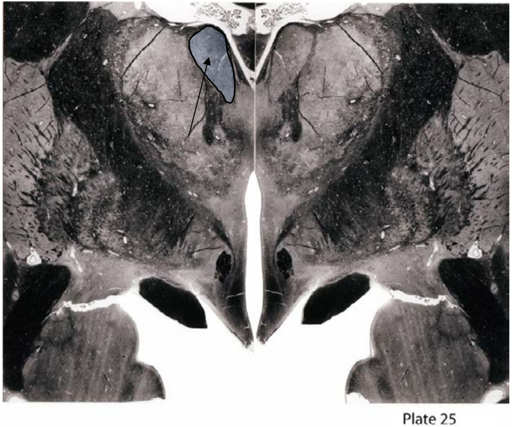 Neuroanatomy Flashcards Memorang