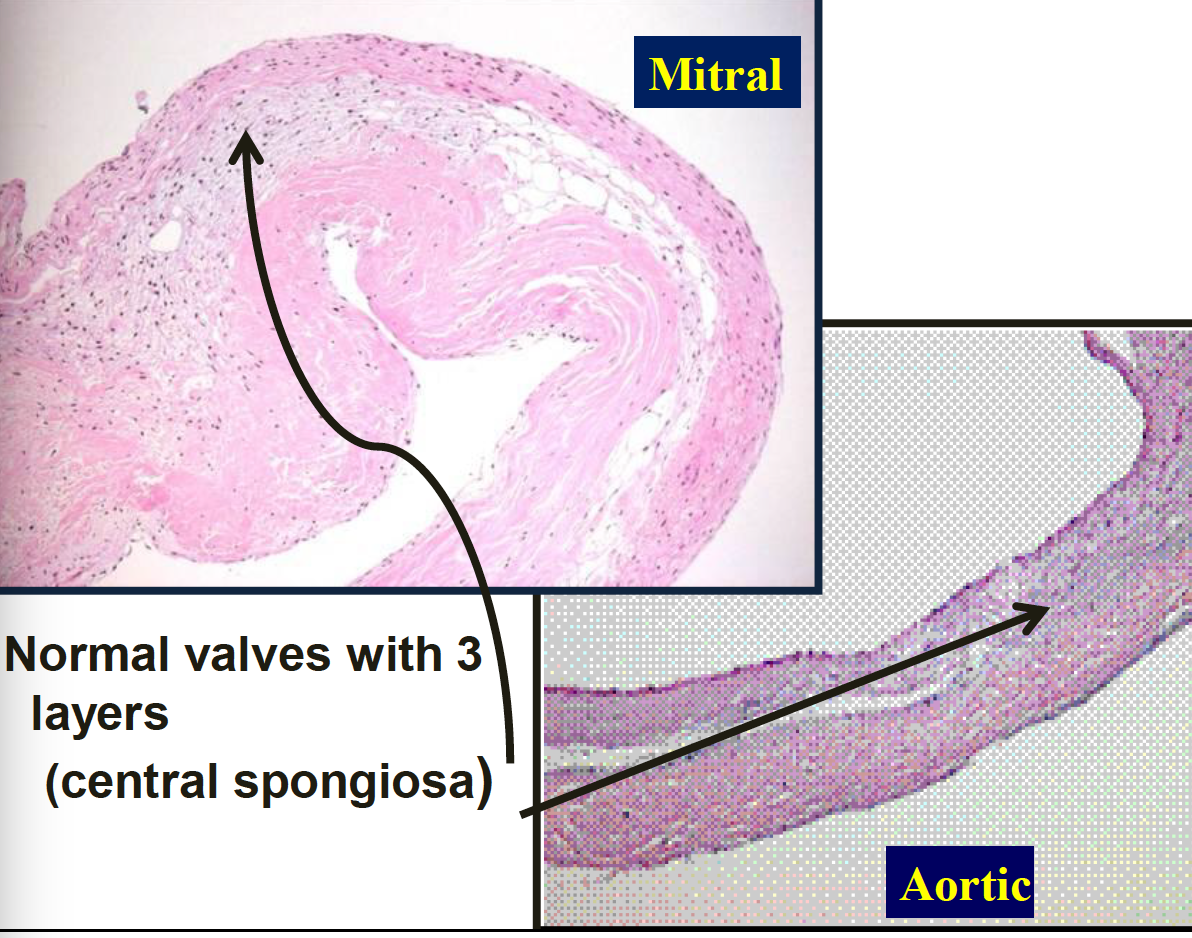 atrioventricular valve histology