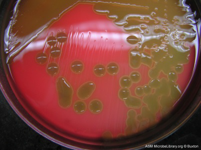 ipsg full form in microbiology