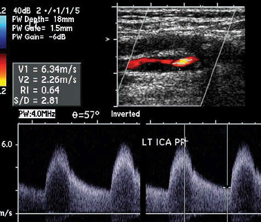 Vascular Flashcards | Memorang