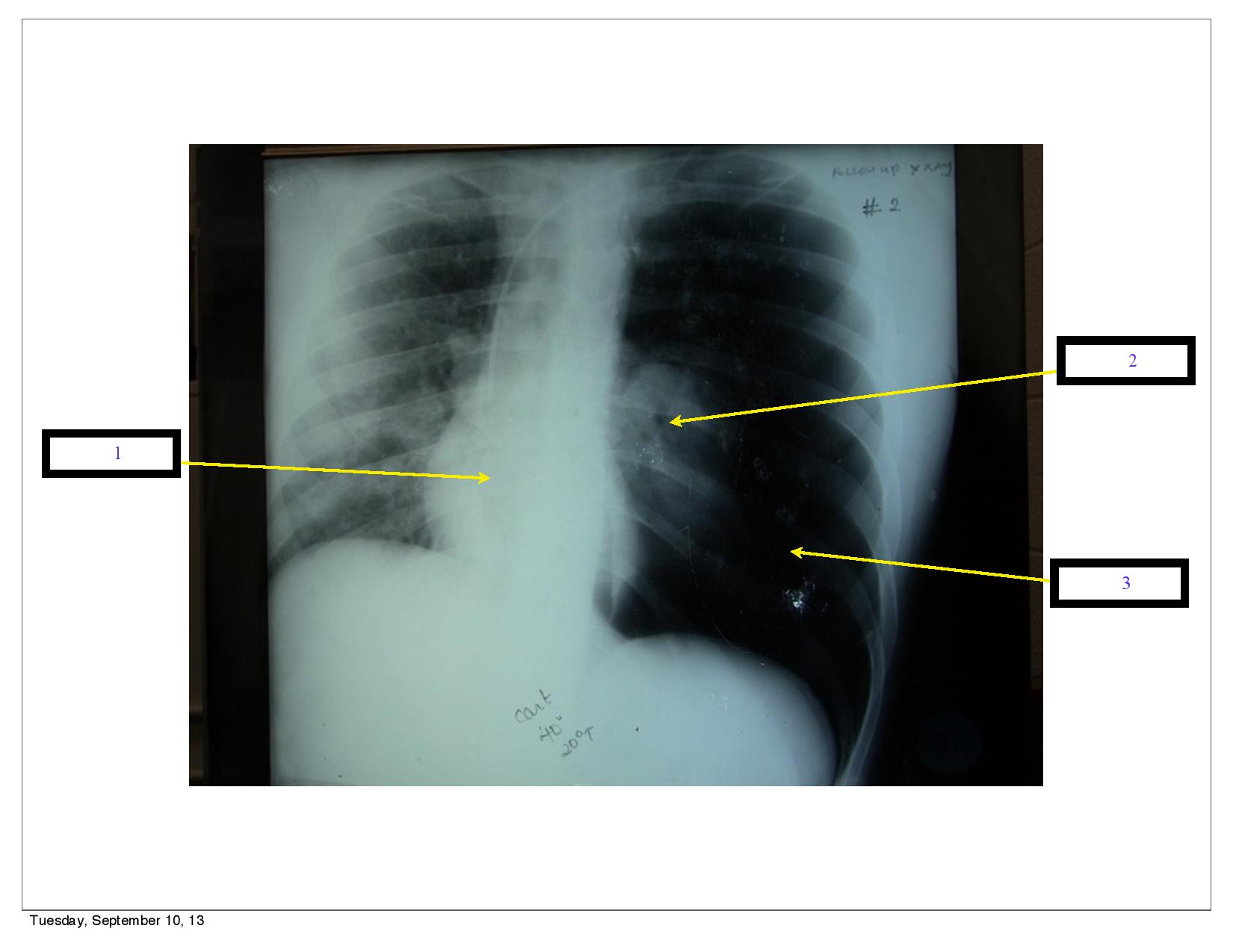 XRays Flashcards Memorang
