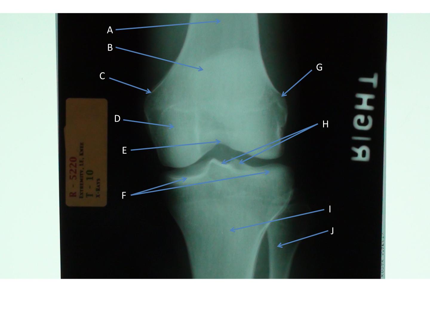 Radiology Flashcards Memorang