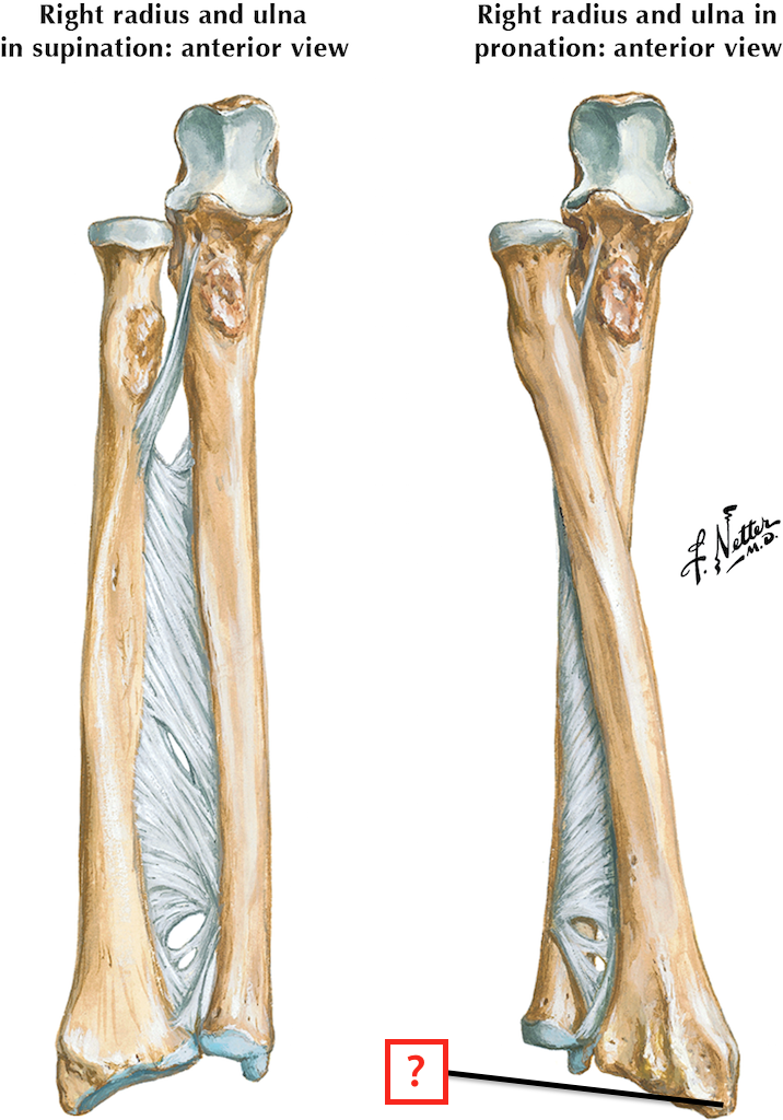 right ulna anterior view