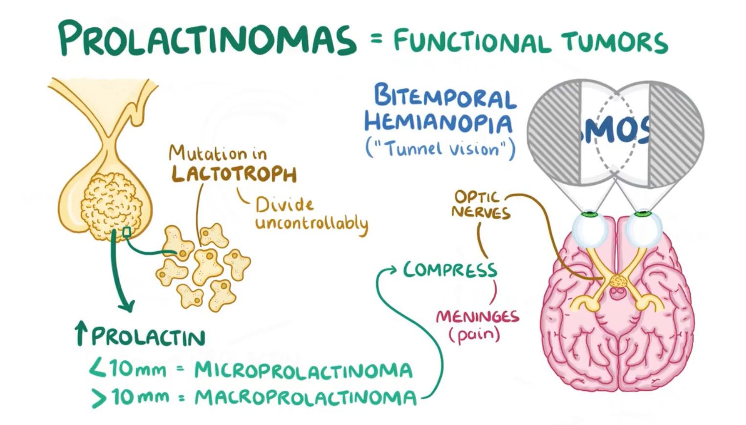 Prolactinoma Flashcards | Memorang