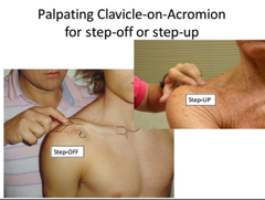 acromioclavicular joint palpation