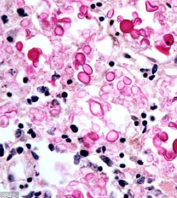 BLHD Microbiology Final Flashcards | Memorang