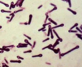 Schaalia Radingae Microbiology Flashcards | Memorang