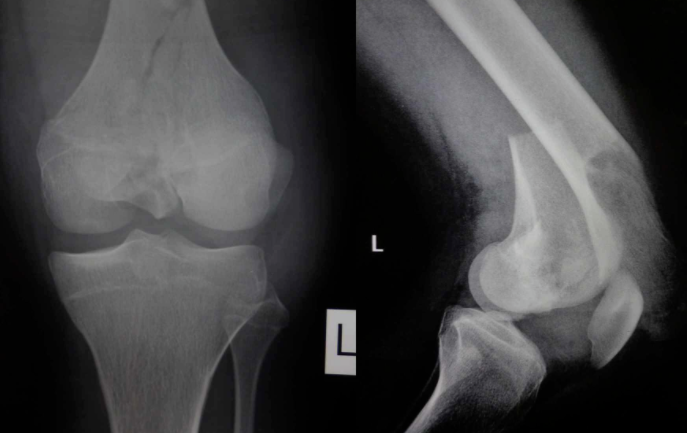 Knee Pathology Flashcards | Memorang