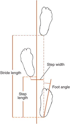 Gait Flashcards | Memorang