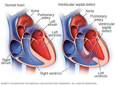 Fysiologie - Cardiovasculair Flashcards 