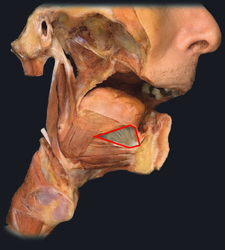 Cadaver Quiz Flashcards Memorang